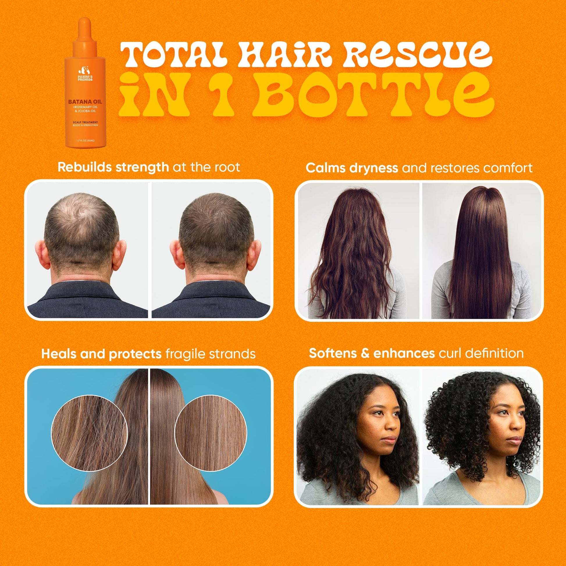 Panda's Promise Batana Oil for Hair Growth with Rosemary Oil, Jojoba Oil & Castor Oil- Natural Dry Scalp Treatment Product for Thinning (2 x 50ML = 100ML)